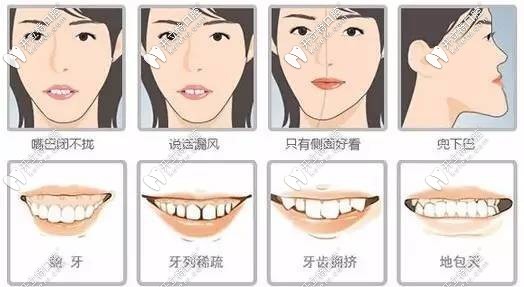 牙齒問題