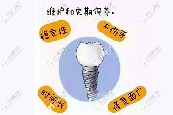 美奧口腔種植牙