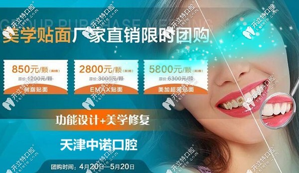 天津中诺口腔瓷贴面优惠价格表