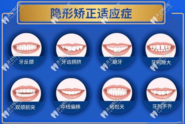 隐形矫正的适应症