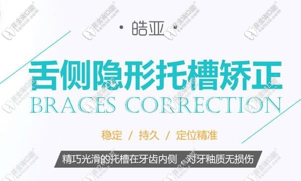皓亞口腔舌側(cè)隱形矯正技術(shù)