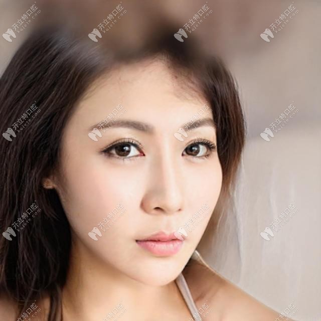 做完樹脂貼面幾年后的圖片證實(shí)牙齒樹脂貼面究竟好不好