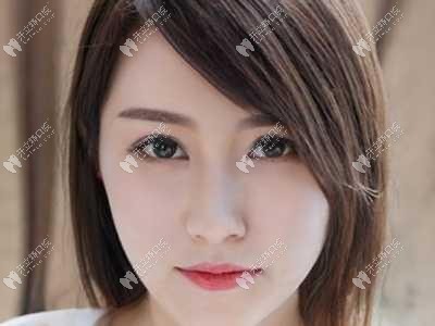 杭州美莱口腔开年钜惠，植体1折种仅限前50名欲报从速哦！