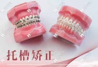 瀏陽北盛羅記牙科金屬牙套價格合理