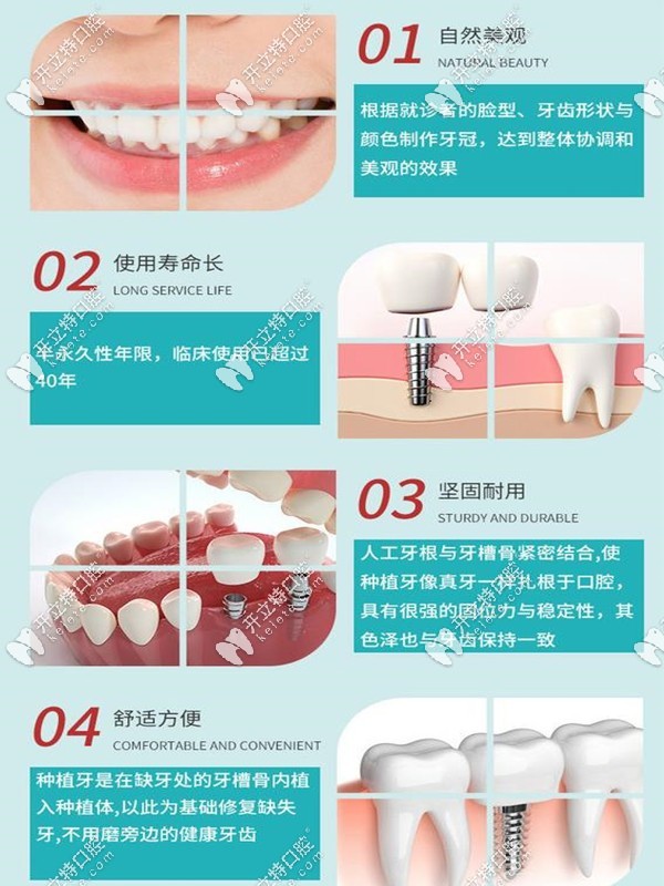 選擇韓系仕諾康種植牙的四大原因