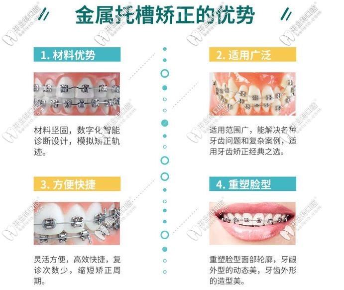 金屬矯正的優(yōu)勢