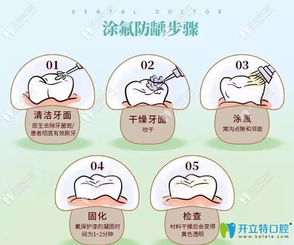東營鉑爾口腔兒童牙齒涂氟步驟