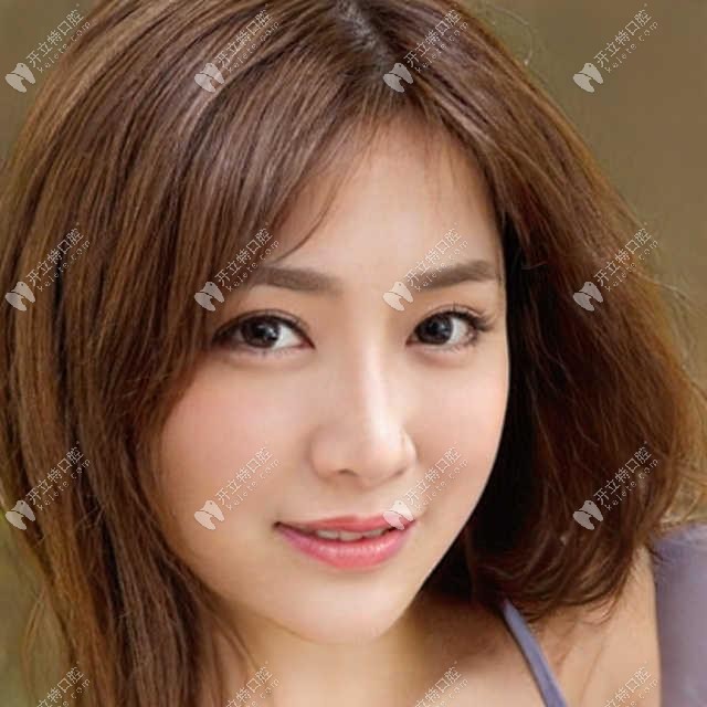 廣州德倫口腔矯正牙齒的費用8800元起,還是數字化美學正畸