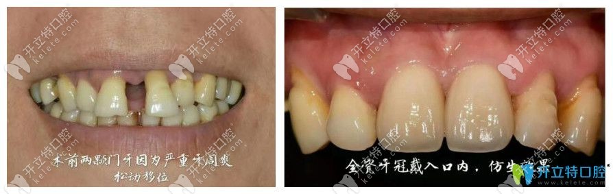陳寧院長親診案例