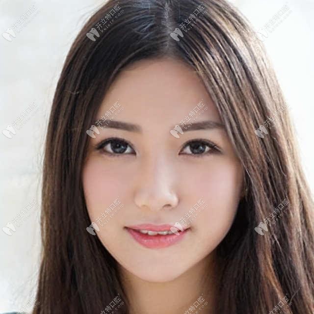 雙11期間在廣州麥特登口腔預(yù)存198元,種植體+補(bǔ)牙+洗牙免費(fèi)享
