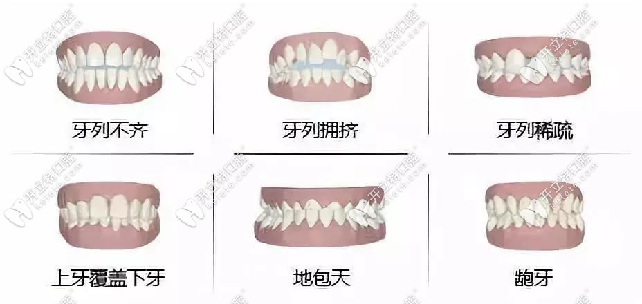 長(zhǎng)汀眾仁牙博仕口腔牙齒矯正價(jià)格