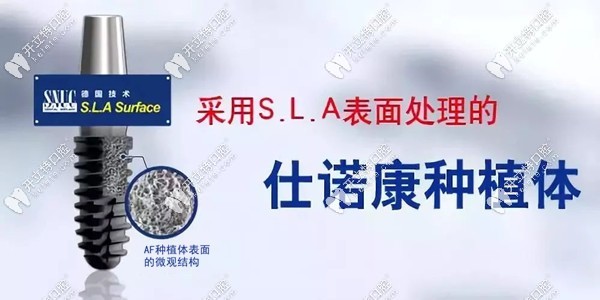 韓系仕諾康種植牙的優(yōu)勢