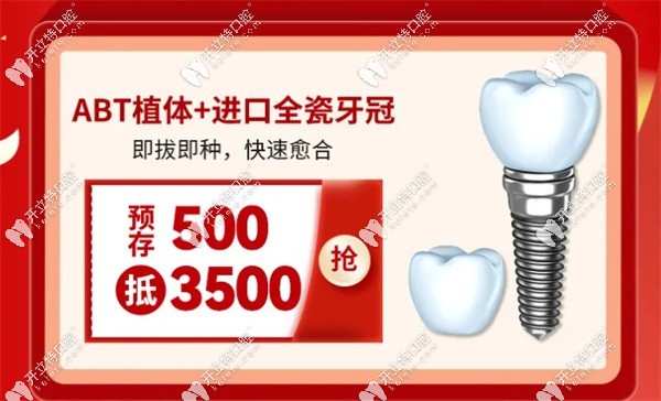 ABT植體+進(jìn)口全瓷牙冠的優(yōu)惠