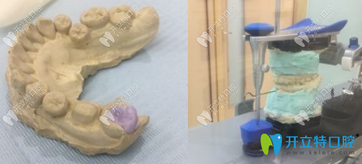 武汉萌芽齿科怎么样？来看顾客看牙后评价