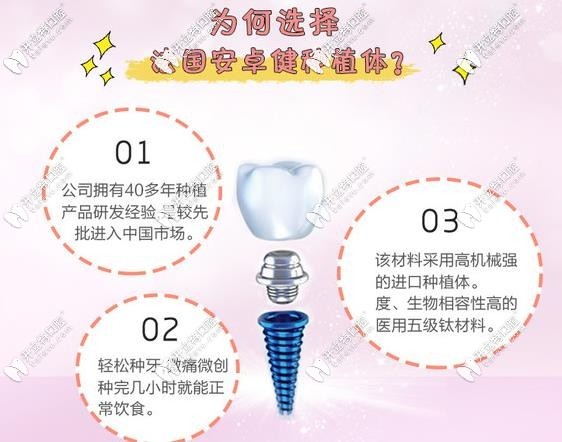 法國安卓健種植體