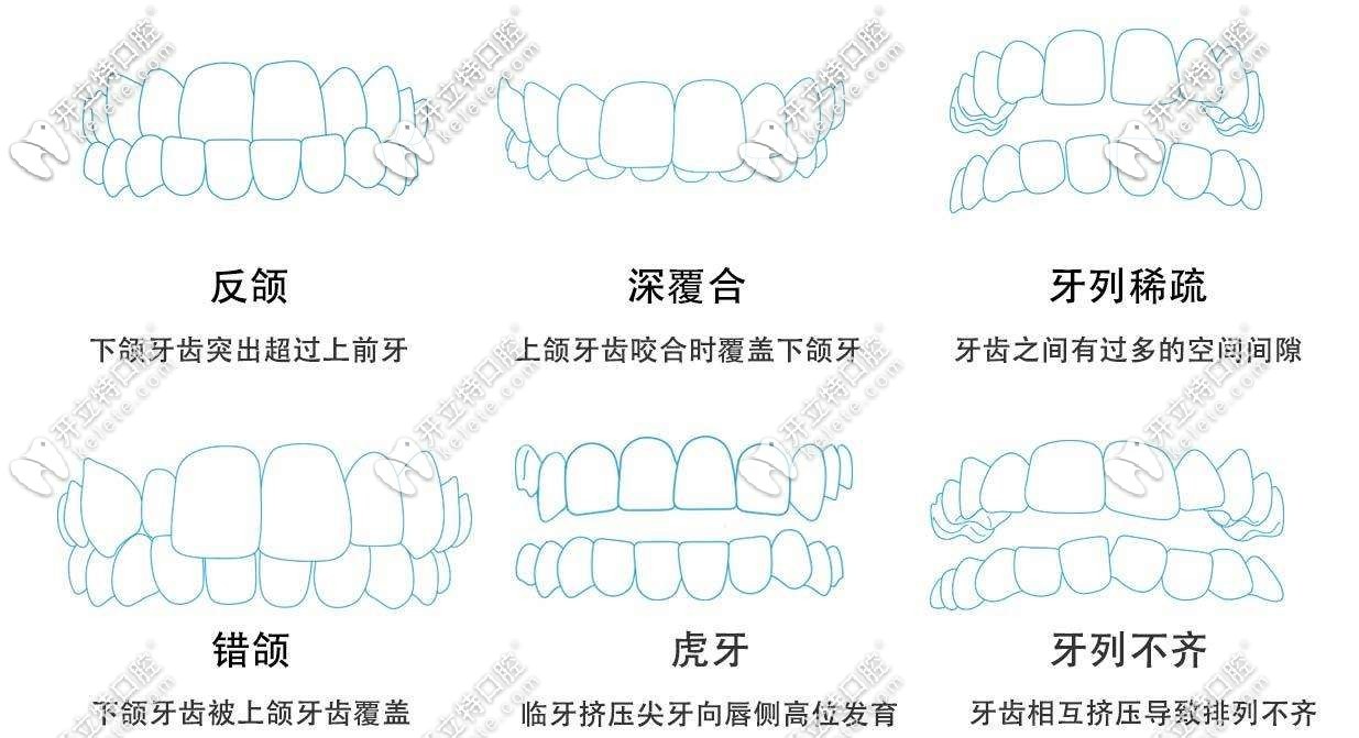 時(shí)代天使可適應(yīng)病例