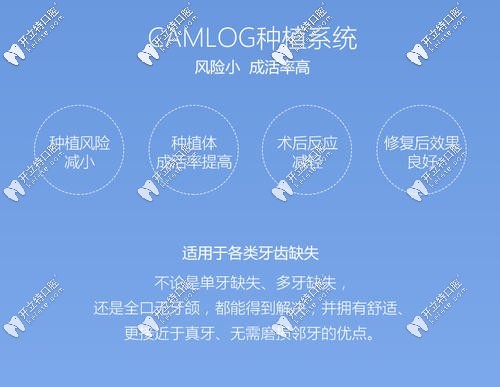 德國(guó)Camlog種植牙優(yōu)勢(shì)