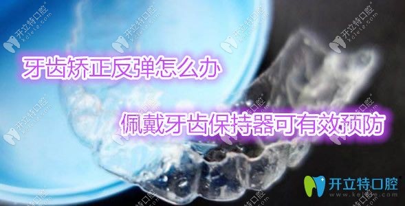 牙齒矯正后為什么一定要佩戴牙齒保持器