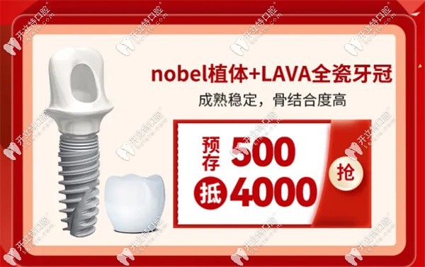 瑞典諾貝爾植體價(jià)格