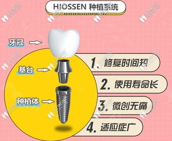 美國皓圣種植體