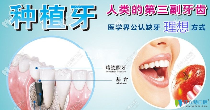 种植牙是人类的第三幅牙齿