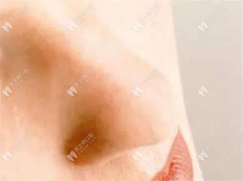 南通通州牙衛(wèi)士口腔正規(guī)嗎?想了解下該院全口種植牙的價(jià)格