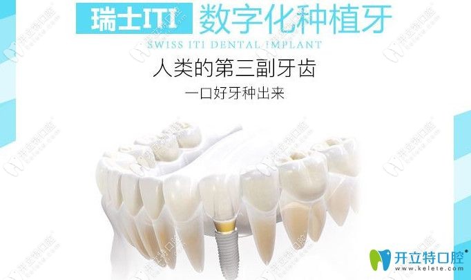 瑞士iti数字化种植牙图解