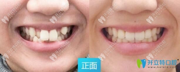 青島維樂口腔好嗎，正規(guī)嗎？真人<span style=