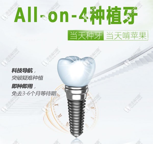 allon4種植技術的特點