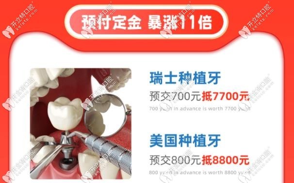 福州貝臣口腔種植牙價格優(yōu)惠活動