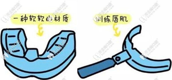 羅慕咬合誘導早期干預矯正