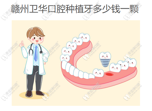 贛州衛(wèi)華口腔種植牙價(jià)格