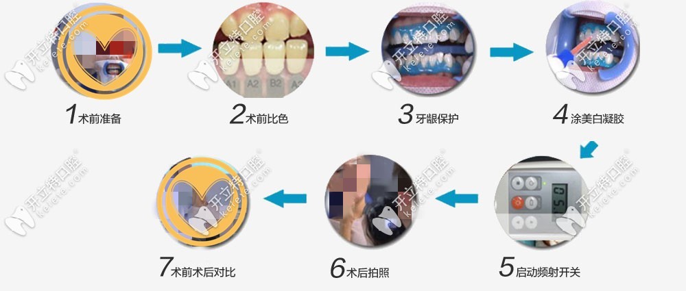 冷光美白的原理及過程
