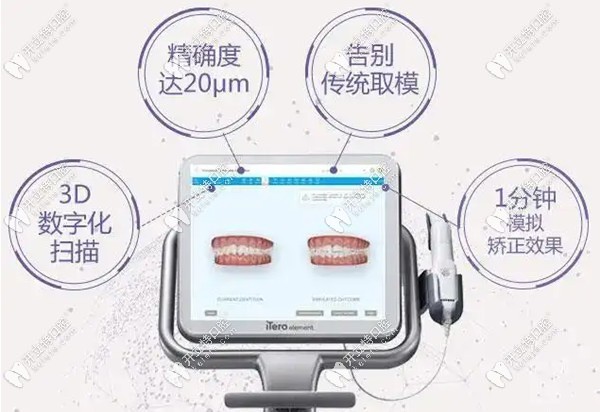3D數(shù)字化口掃儀器