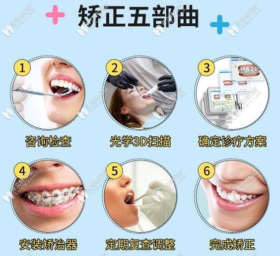 <!--<i data=20240703-sp></i>-->美口腔牙齒矯正步驟圖