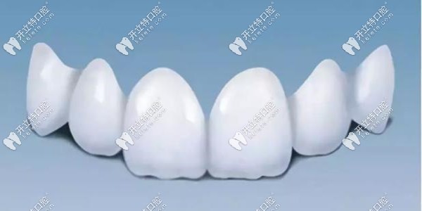 成都<!--<i data=20240703-sp></i>-->口腔綜合項(xiàng)目收費(fèi)不貴kelete.com