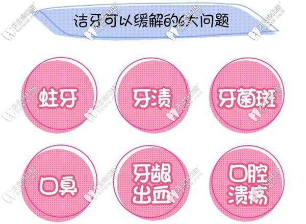 潔牙可緩解的問題