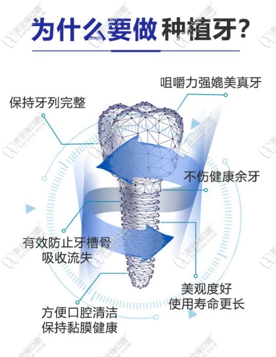 為什么要做種植牙的原因