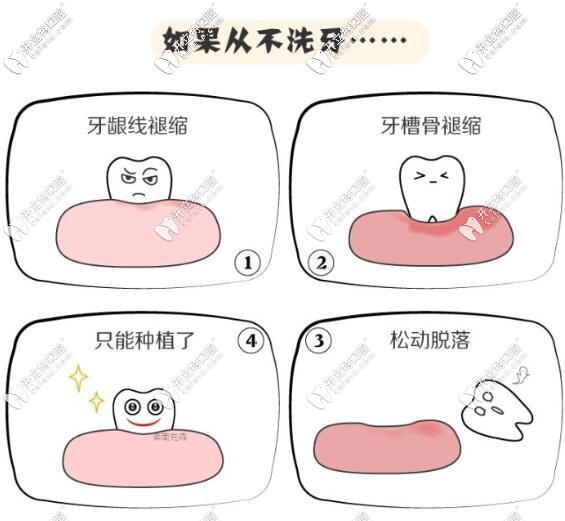 不洗牙的危害
