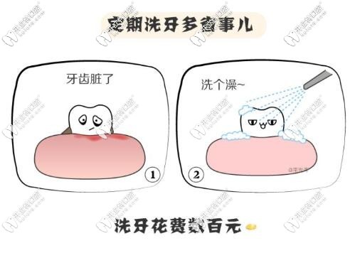 洗牙