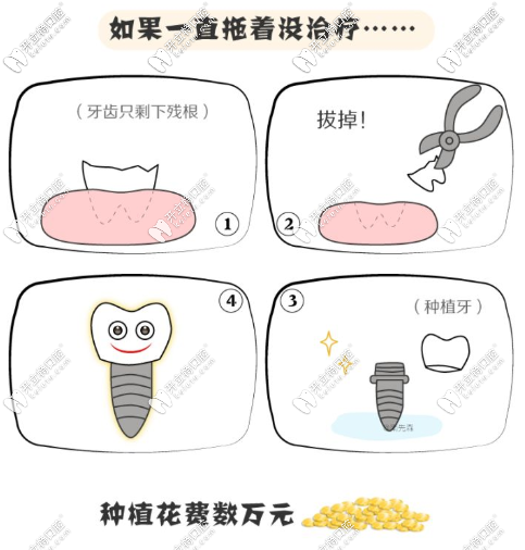 齲齒不治療的危害