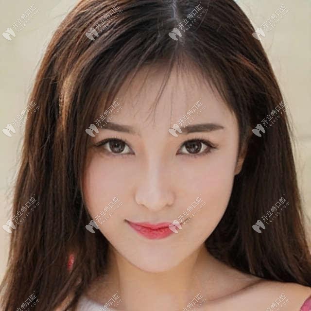 一位看牙過來人爆料西安美奧口腔收費(fèi)高嗎,奉上價(jià)格表