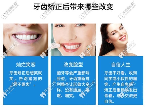 沈陽米蘭牙齒矯正