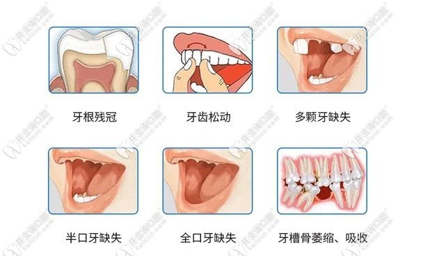 北京瑞泰口腔種植醫(yī)生