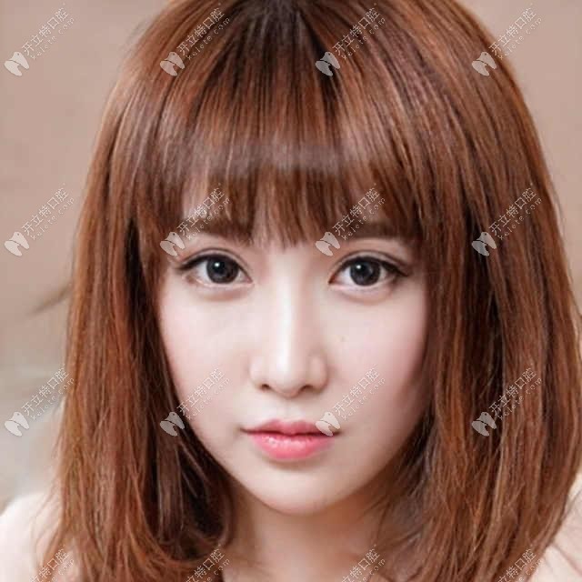 整理重慶華諾世口腔2019價(jià)格表 把矯正牙種植牙案例也分享了