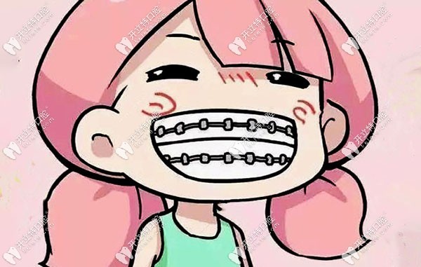 汉中齿博士牙齿矫正价格