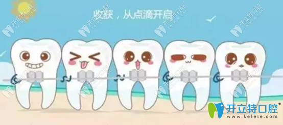 牙齒矯正好后保持器要戴多久