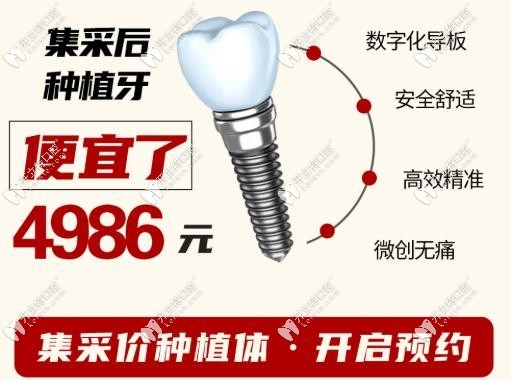 廈門麥芽口腔種植牙集采價格直降4986元