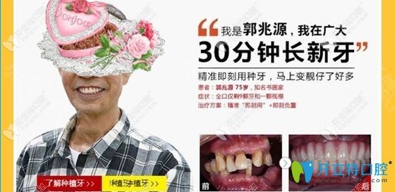廣州廣大口腔用3D導板種植牙技術(shù)做的全口牙種植效果圖