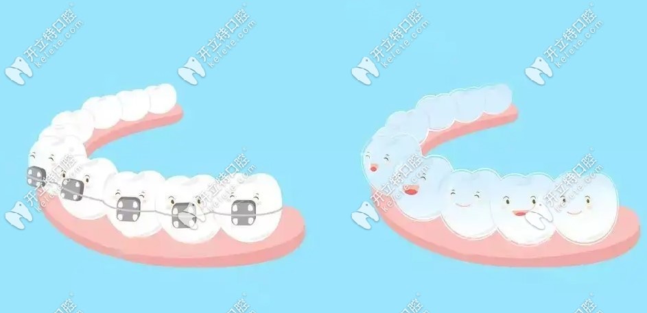合肥美奧口腔牙齒矯正價格貴嗎